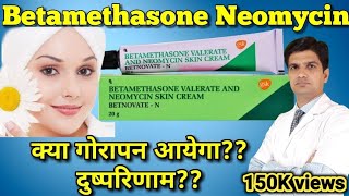 Betnovate N cream  Betamethasone Neomycin cream  betnovate n skin cream [upl. by Narol343]