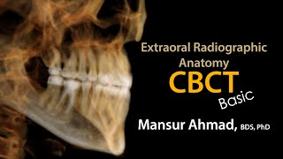 Basic CBCT ConeBeam CT Anatomy [upl. by Toland]