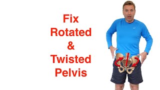 How to Fix a Rotated Pelvis in SECONDS [upl. by Irtimd]