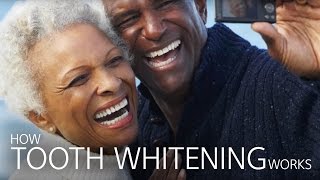 How Tooth Whitening Works [upl. by Nyrehtak]