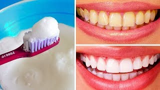 10 Natural Ways to Whiten Teeth at Home [upl. by Esylla]