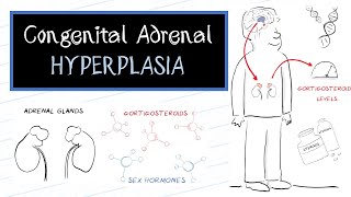 What is Congenital Adrenal Hyperplasia CAH [upl. by Aerised]