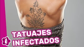 Tatuajes infectados cómo curarlos [upl. by Sitnalta989]