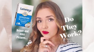 Lumineux Whitening Strips  Honest Review [upl. by Stephine772]