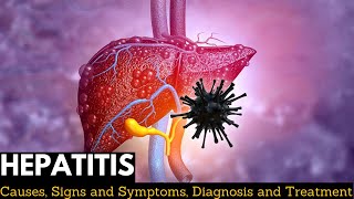 Hepatitis A B C D E Nursing Symptoms Treatment Causes NCLEX [upl. by Asher]