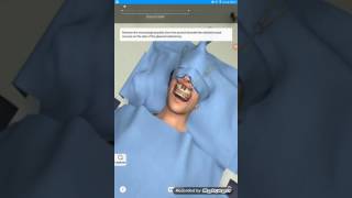 LOQTEQ® High Tibia Osteotomy 45  Surgical Technique [upl. by Ecitsuj946]