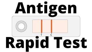 How SARSCoV2 Antigen Rapid Tests work Covid19 Testing [upl. by Allisirp]