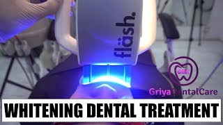 WHITENING TEETH  DENTAL BLEACHING [upl. by Darej]