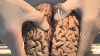 Introduction Neuroanatomy Video Lab  Brain Dissections [upl. by Ademla]