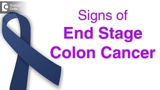 Colon v Rectal Cancer What you need to know [upl. by Bentlee]