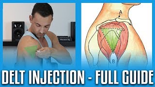 How To Do A Deltoid Injection  Full GuideDemo [upl. by Lennard149]