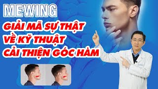 Mewing là gì Câu hỏi thường gặp về Mewing  Nam Bùi Vinalign [upl. by Akcirderf]