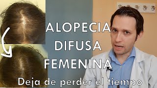 Alopecia difusa femenina mejor tratamiento dermatologo te lo explica [upl. by Bearnard]