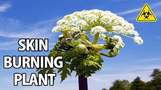 Giant Hogweed  A FleshBurning Plant Explained [upl. by Oloapnaig]