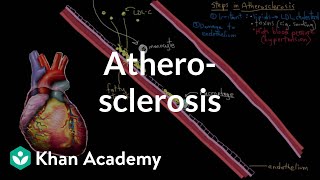 Atherosclerosis  Circulatory System and Disease  NCLEXRN  Khan Academy [upl. by Maro601]