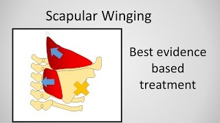 Scapular Retraction Test SRT ⎟ Scapular Dyskinesis [upl. by Eichman]