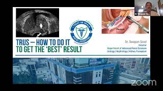 TransRectal Ultrasound  How To Do It amp How To Get Best Result  Urology  Uroradiology [upl. by Aerdnek]