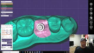 How to Create Implant Models from Intra Oral Scans [upl. by Nnoj]