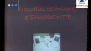 Traitement endodontique technique dobturation dentaire [upl. by Reifinnej]