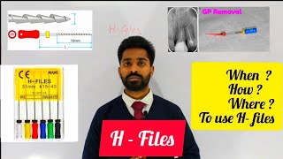 H  Files in Endodontics [upl. by Wight]