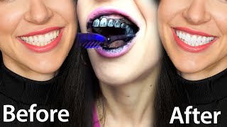 Fastest Way To Whiten Teeth At Home What REALLY Works [upl. by Yenterb746]